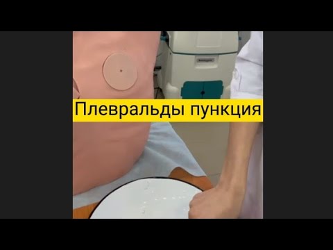 Видео: Пневмоторакс кезіндегі Плевральды пункция жасау техникасы. Плевральная пункция  при пневмотораксе.