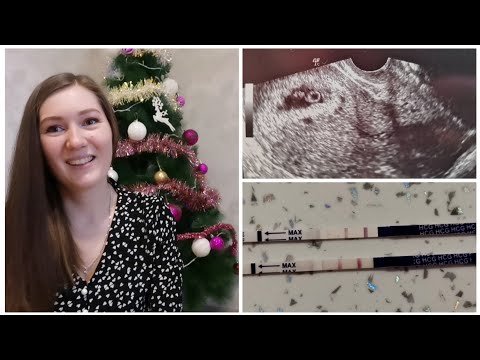 Видео: ДНЕВНИК БЕРЕМЕННОСТИ/КАК УЗНАЛИ О БЕРЕМЕННОСТИ/ 4-7 НЕДЕЛЯ/СИМПТОМЫ /ТОКСИКОЗ