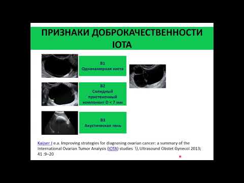 Видео: Классификация очаговой патологии миометрия FIGO. IOTA анализ