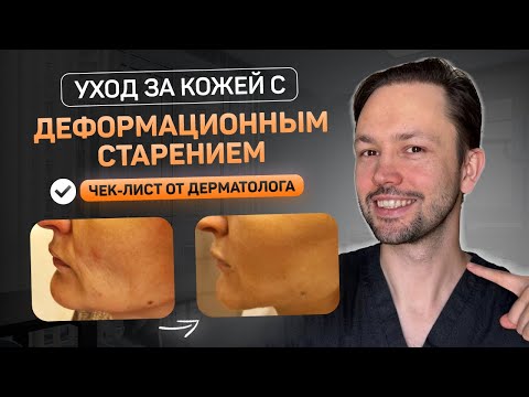 Видео: Уход при деформационном старении