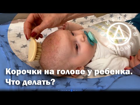 Видео: Корочки на голове у ребенка. Что делать?