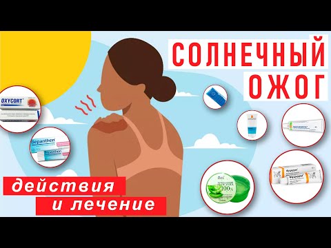 Видео: После солнечного ожога: лекарства и действия
