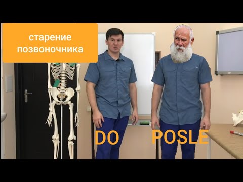 Видео: Причина старения позвоночника. Остеохондроз. Артроз