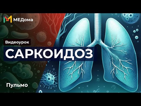 Видео: Саркоидоз легких: Патогенез, Симптомы, Лечение и Диагностика | Медома | Подготовка к USMLE Step 1