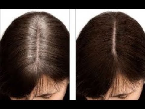 Видео: Как ИЗБАВИТЬСЯ от СЕДИНЫ . Бюджетно и ЛЕГКО !