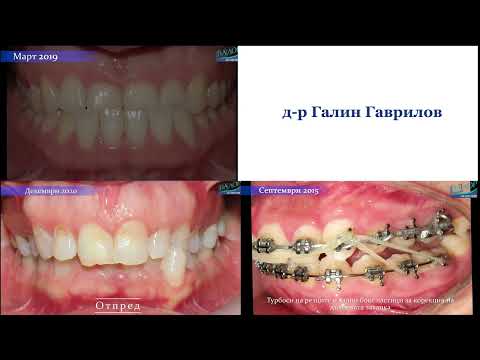 Видео: ТВ рецепция 2