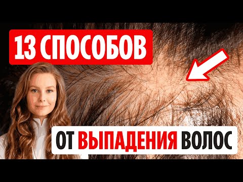 Видео: Все способы остановить выпадение. Плюсы и минусы.