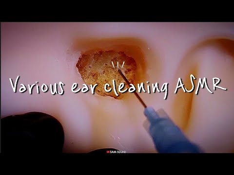 Видео: ASMR Для тех, кто не может уснуть ... ★ От мягкого до интенсивного !!! Различная чистка ушей