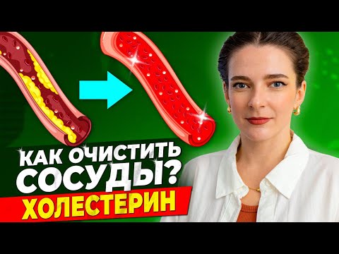 Видео: КАК СНИЗИТЬ ХОЛЕСТЕРИН? Как очистить сосуды от холестерина? Плохой и хороший холестерин (ЛПНП/ЛПВП)