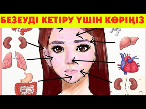 Видео: БЕЗЕУДІ ТЕЗ КЕТІРУДІҢ 4 ӘДІСІ, Безеуден түк қалмайды, Керек арнасы