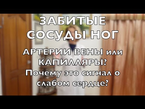 Видео: ЗАБИТЫЕ СОСУДЫ ног. Как именно бывают забиты и почему КАРДИОЛОГ всегда интересуется ногами?