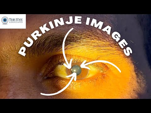 Видео: Изображения Пуркинье