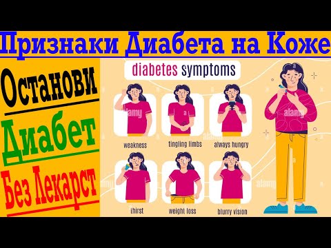 Видео: Признаки диабета на Коже! Как остановить диабет до появления или вылечить без лекарств?!