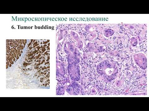 Видео: Гистологическое исследование материала эндоскопических диссекций ЖКТ (ГоловановаТ.С.)