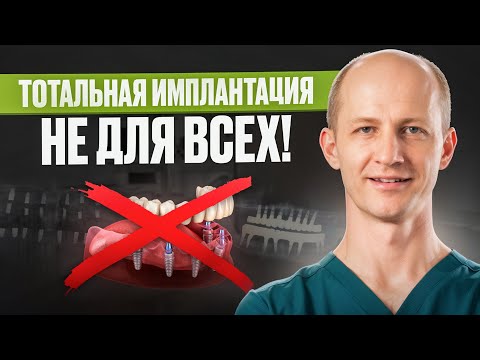 Видео: Не делай ИМПЛАНТАЦИЮ, пока не посмотришь это видео!