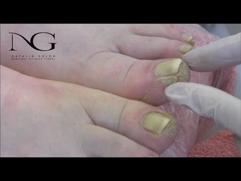 Видео: Особенности аппаратного педикюра . Часть 1 / Features hardware pedicure. Part 1