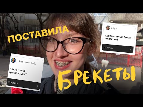 Видео: я поставила брекеты // сколько стоит??