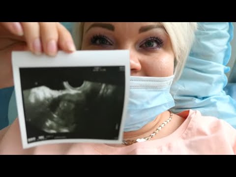 Видео: ЭКО !!! Подсадка эмбриона!!