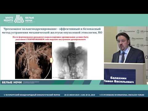 Видео: Стентирование полых органов в онкологии: Роль рентгенохирургических технологий (Балахин П.В.)