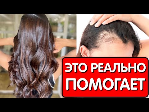 Видео: Нанесла это средство и МОИ ВОЛОСЫ РАСТУТ БЫСТРО и стали гуще в 3 раза ! МАСКА СПАСЛА ОТ ОБЛЫСЕНИЯ