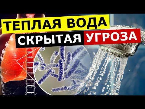 Видео: ОПАСНОСТЬ в бойлере и бассейне: бактерия легионелла (пахнет вода)