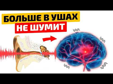 Видео: ШУМЕЛО 3 ГОДА — УШЛО ЗА 5 МИНУТ! 1 ПРОСТОЕ движение и ШУМ в ушах ПРОПАЛ навсегда! Тиннитус