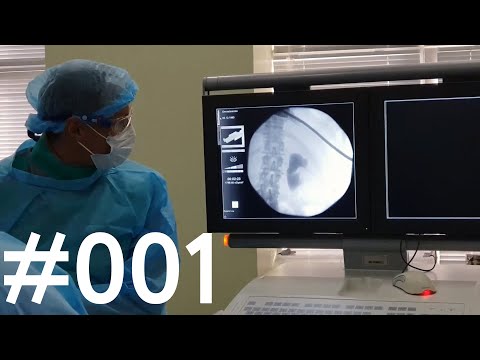 Видео: Что такое интервенционная онкология?