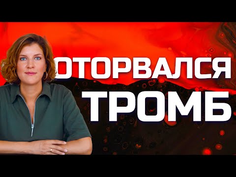 Видео: Тромб оторвался - тромбоэмболия легочной артерии