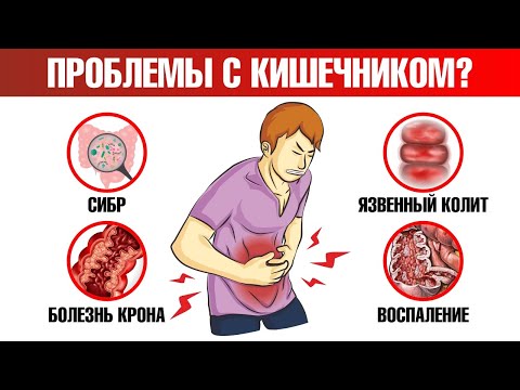 Видео: Самый простой способ определить, есть ли проблемы с ЖКТ🙌