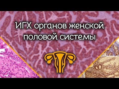 Видео: ИГХ органов женской половой системы
