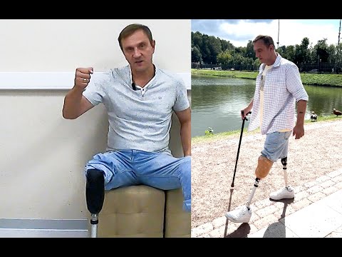 Видео: Эпилог. Реабилитация после ампутации ноги: "Многое зависит от Вас"