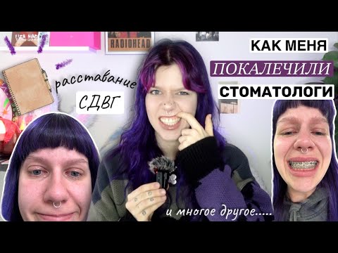 Видео: ВОПРОС ОТВЕТ | расставание, СТОМАТОЛОГИ КОТОРЫЕ ПОКАЛЕЧИЛИ и многое другое….