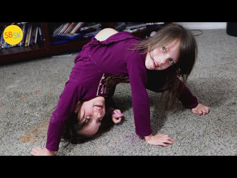 Видео: Сиамские близнецы и лучшие друзья (История Кэлли и Картер)