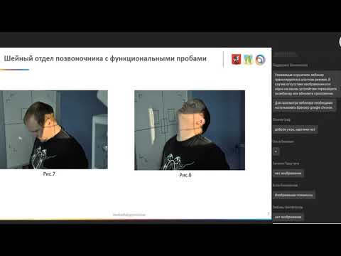Видео: Технологии проведения рентгенологических исследований позвоночника
