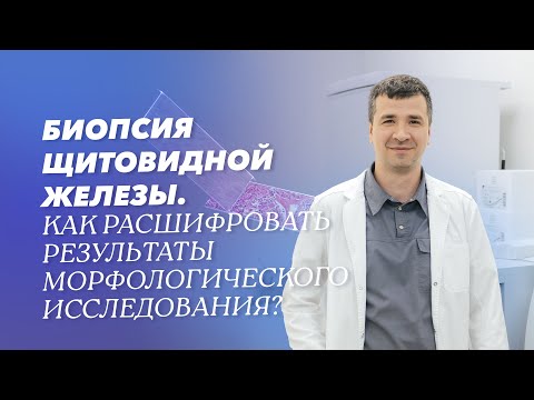 Видео: Биопсия щитовидной железы: результаты морфологического исследования