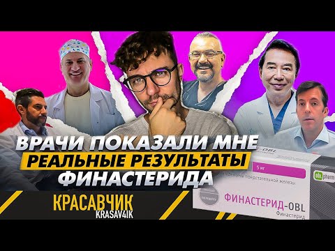 Видео: Финастерид и миноксидил: Что врачи действительно думают об эффективности и рисках / KRASAV4IK