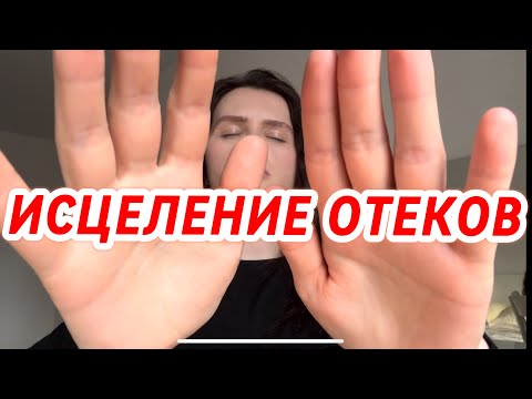 Видео: ИСЦЕЛЕНИЕ ❤️‍🩹 ОТЕКОВ/Healing orders