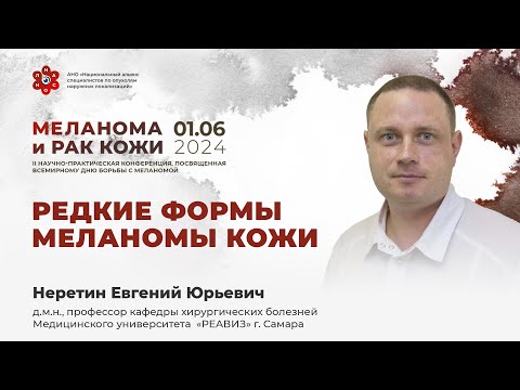 Видео: Редкие формы меланомы кожи. Неретин Е. Ю.