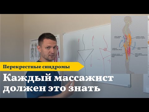 Видео: Нижний перекрестный синдром | Передний наклон таза