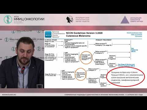 Видео: Этапность хирургической помощи. Место БСЛУ и лимфодиссекций (Зиновьев Г.В.)
