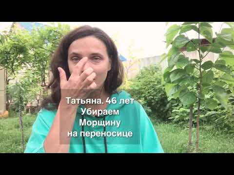 Видео: Морщина на переносице