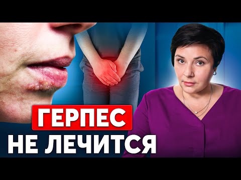 Видео: САМЫЙ ОПАСНЫЙ ВИРУС! Почему герпес невозможно вылечить?