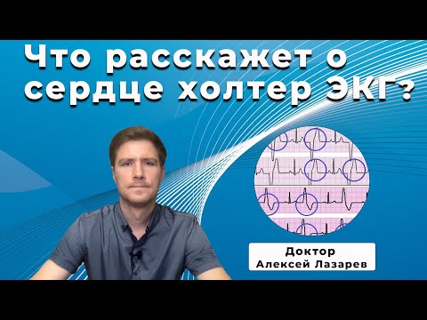 Видео: ЧТО РАССКАЖЕТ О СЕРДЦЕ ХОЛТЕР ЭКГ? #холтерЭКГ #ЭКГ #ДокторАлексейЛазарев
