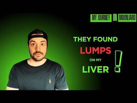 Видео: Монджаро и мои снимки печени. Что обнаружили врачи!