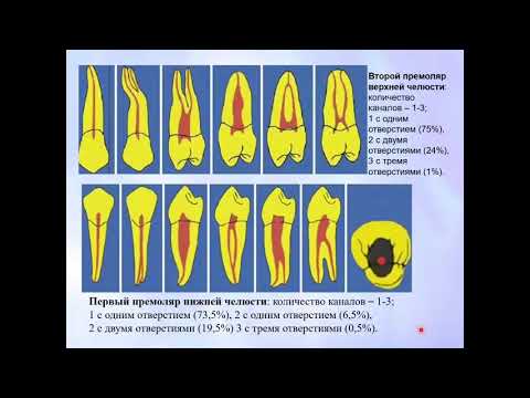 Видео: Эндодонтия 1. Основные понятия. Этапы эндодонтического лечения