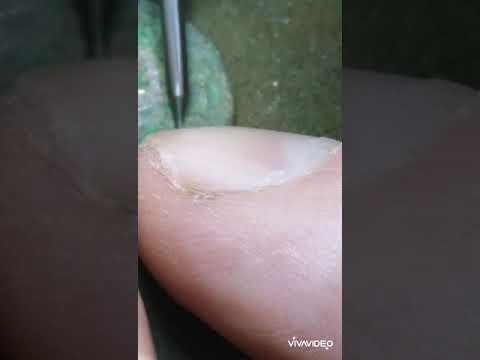 Видео: чистка шаберами,мех чистка монет.