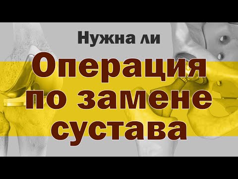 Видео: Почему может понадобиться замена сустава? [S05E02]