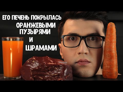 Видео: Британец Выпил 40 Литров Морковного Сока. Вот Что Случилось с Его Печенью...
