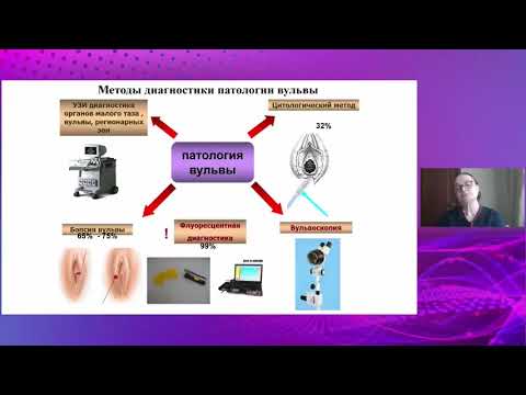 Видео: Фотодинамическая терапия (ФДТ) в лечении доброкачественных и предраковых поражений вульвы