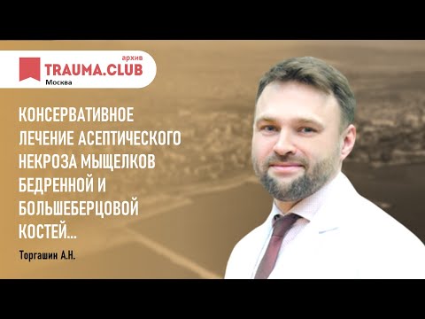 Видео: Консервативное лечение асептического некроза мыщелков бедренной и большеберцовой костей